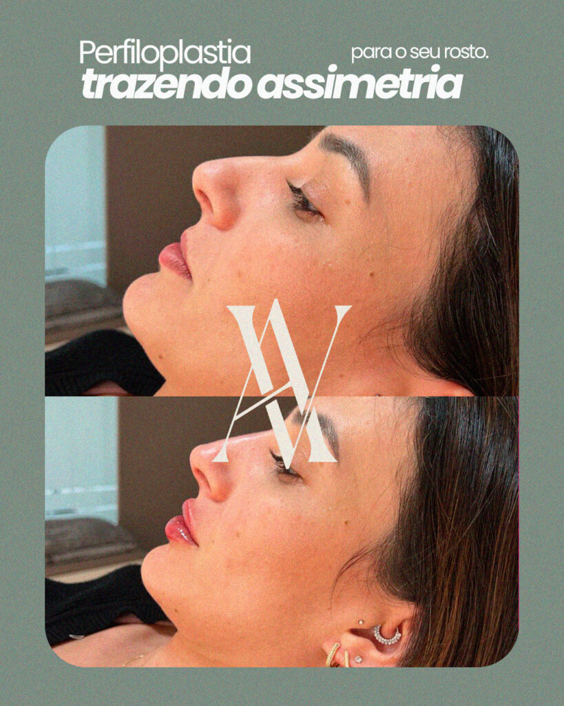 Arte 2